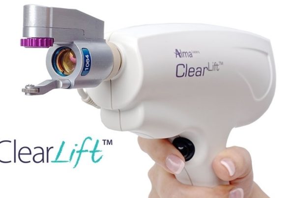 Alma Q Clearlift